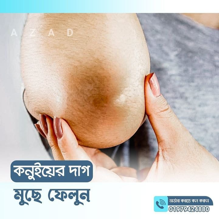 imgi_5_WhatsApp-Image-2024-10-24-at-02.36.09_b5618901